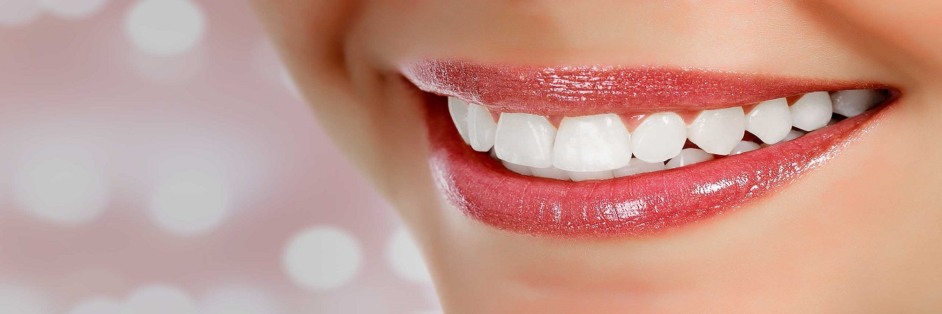 Smile satisfaction gurantee with Ceramic Veneers