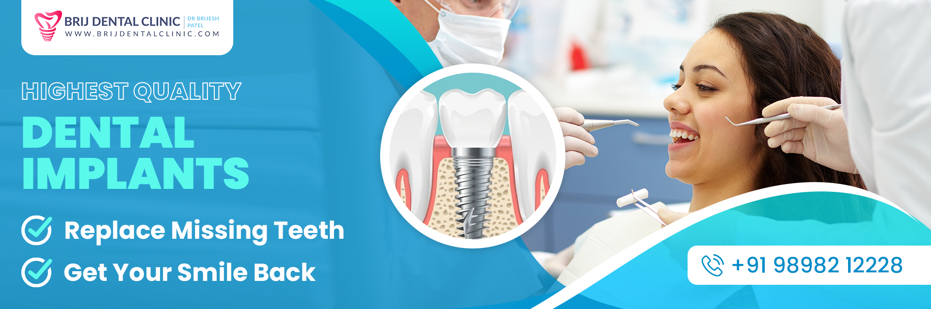 Highest quality Dental Implants