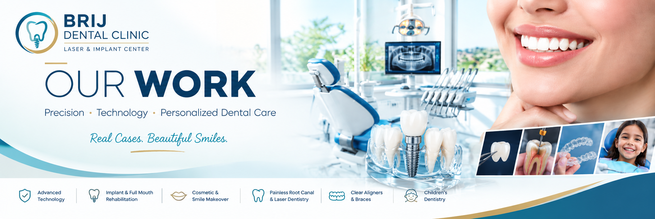 Best Dental work at Brij Dental Clinic, ahmedabad india