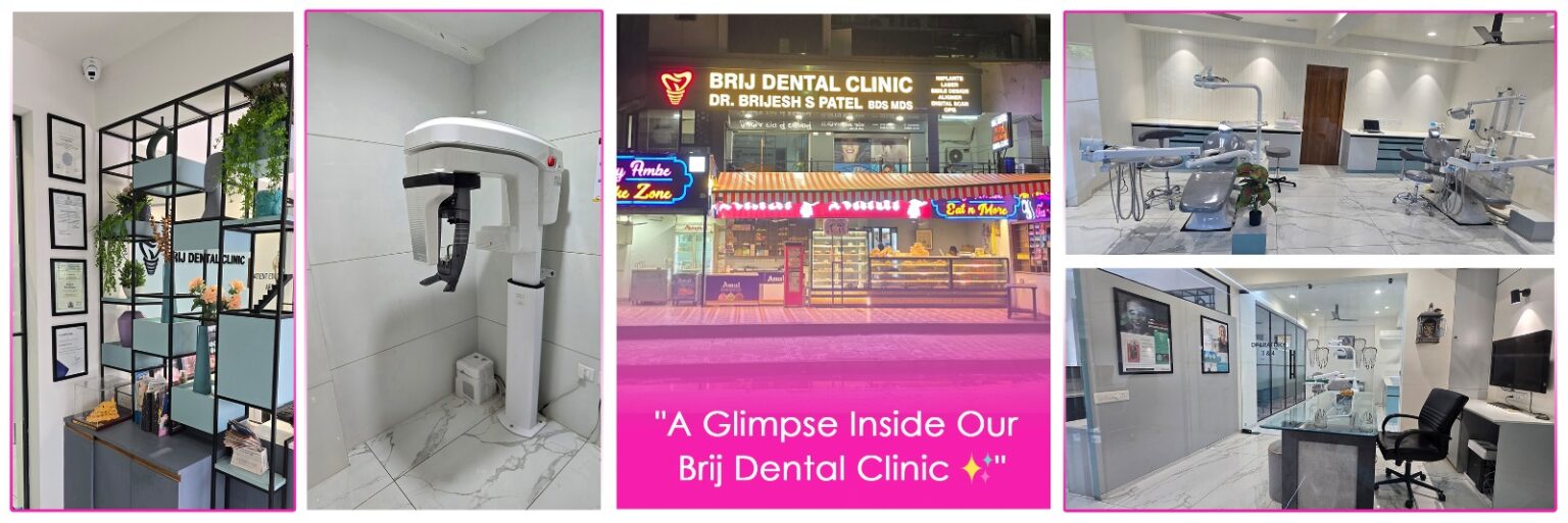 Brij Dental Clinic, Best Advanced Dental Clinic Ahmedabad, India