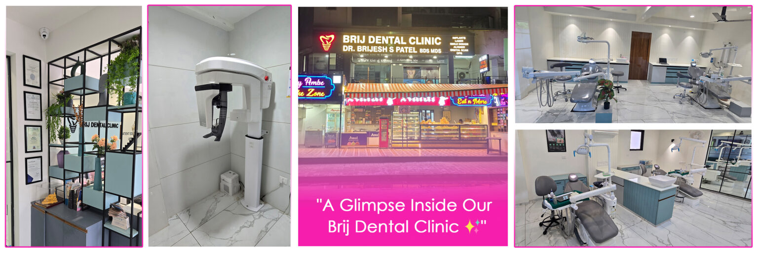 Brij Dental Clinic, Best Advanced Dental Clinic Ahmedabad, India.