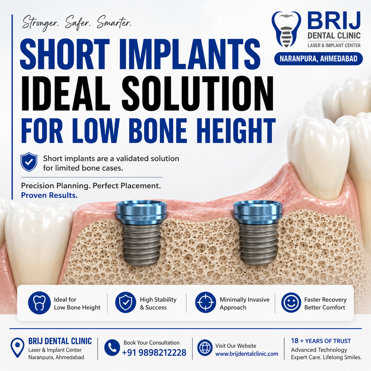 SHORT DENTAL IMPLANT IN AHMEDABAD INDIA