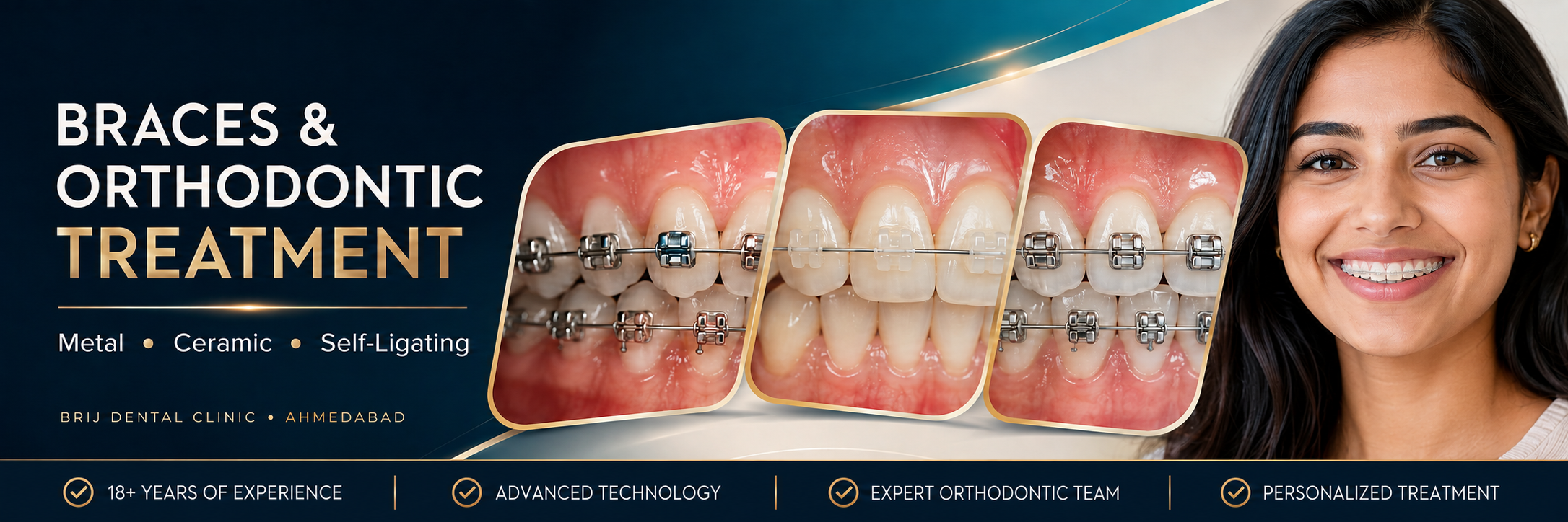 BRACES TREATMENT IN AHMEDABAD INDIA WITH BEST ORTHODONTIST AT BRIJ DENTAL CLINIC