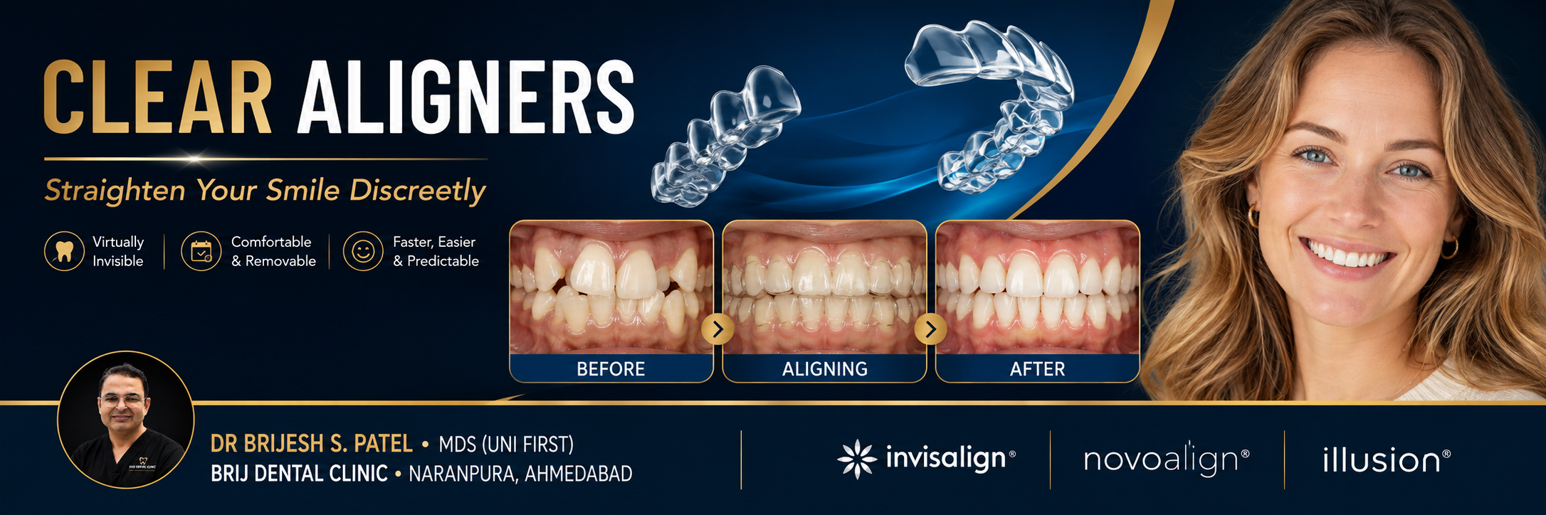 Best Invisible clear aligners in ahmedabad inida