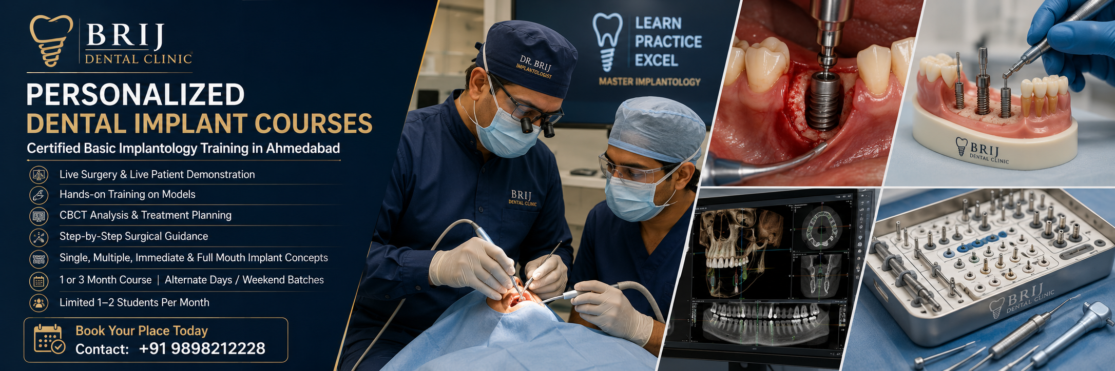 Personalized dental implant course in ahmedabad at Brij dental clinic