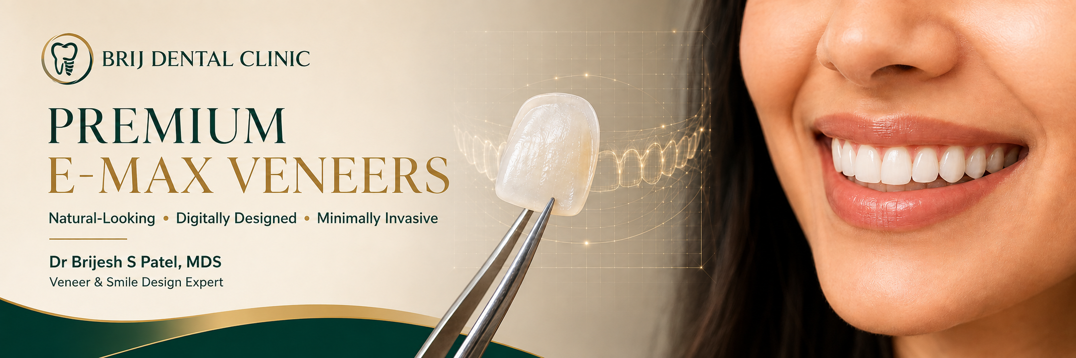 Premium Emax Veneers in Ahmedabad India, by best Smile Design expert.