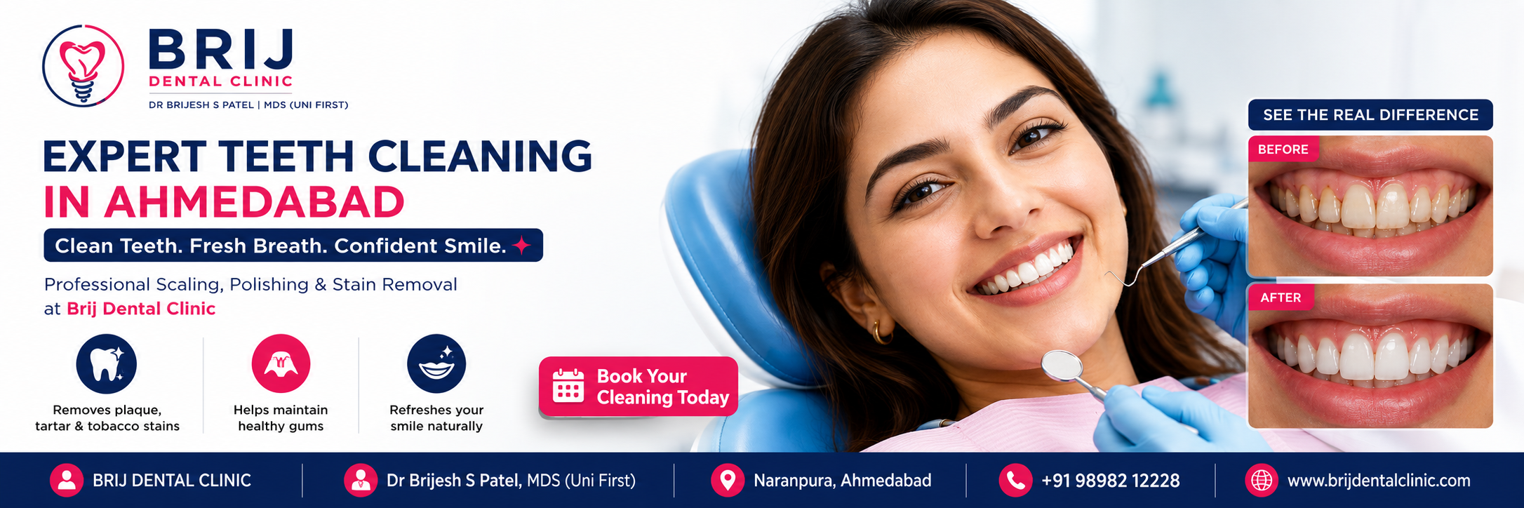 TEETH CLEANING IN AHMEDABAD INDIA