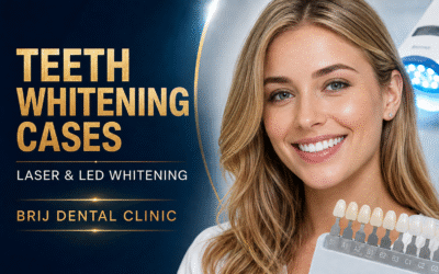 TEETH WHITENING CASES IN AHMEDABAD INDIA