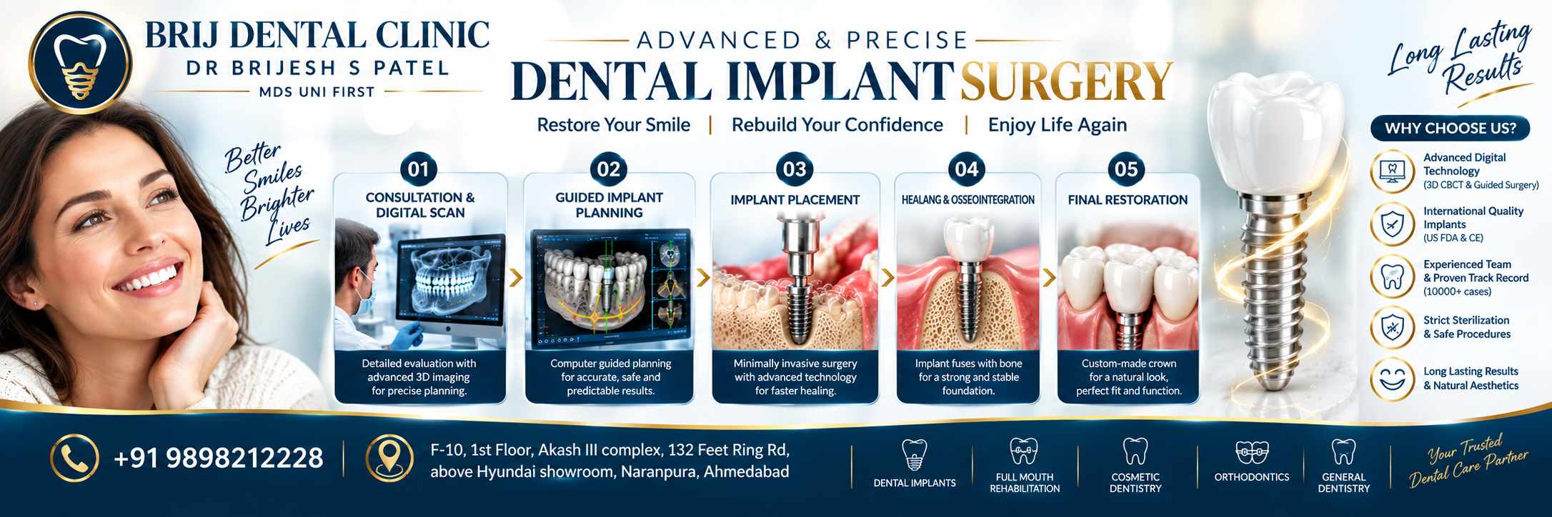 DENTAL IMPLANT IN AHMEDABAD, MOST ADVANCED AND DIGITAL DENTALCLINIC